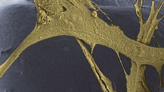 Im Gerüst des Polymerschaums finden Zellen Halt, um neues Hautgewebe aufzubauen. (Empa)