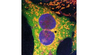 Human cells that have been edited with the new retron-based gene editing technology. Orange dots mark successful gene edits. Green dots show a fluorescent protein tag on the surface of mitochondria.
 (Source: You-Chiun Chang/ University of Texas at Austin)