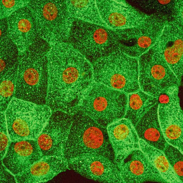 In den Nierenzellen der Ratte befindet sich das grün markierte Aquaporin AQP2 im Zellinneren, wenn sie weder durch das Hormon noch durch ein Medikament stimuliert wurden. Zellkerne erscheinen rot. (AG Klussmann, MDC)