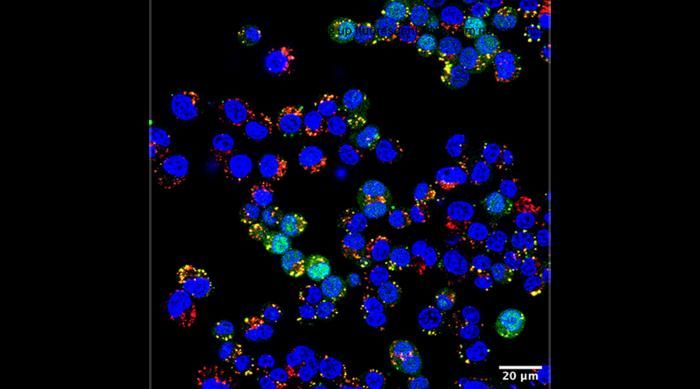 Nanopartikel-Revolution   Forscher an der University of Chicago Pritzker School of Molecular Engineering haben Polymer-Nanopartikel entwickelt, die sich durch eine einfache Temperaturänderung bei Raumtemperatur selbst in Wasser zusammenfügen.  Das Besondere: Diese neuen Nanopartikel ermöglichen die Lieferung von Proteinen, die bei bestehenden Nanopartikel-Formulierungen oft instabil sind. Dabei benötigt die Methode keine schädlichen Chemikalien oder spezielle Ausrüstung. Anders als bei traditionellen lipidbasierten Nanopartikeln (LNPs), die alkoholische Lösungsmittel und komplexe Herstellungsprozesse benötigen, sind diese Polymersome einfach und skalierbar.  Die Partikel können mehr als 75% Protein und fast 100% siRNA einkapseln und bieten die Möglichkeit, ohne Kühlung gelagert zu werden. Experimente zeigten, dass die Polymersome wirksam Immunreaktionen auslösen oder unterdrücken und Tumorwachstum inhibieren können. Der Vorteil dieser Technologie ist die Möglichkeit zur dezentralen Produktion und Lagerung, was eine weltweite Verwendung in Impfstoffen und Medikamenten ermöglicht.  Auf dem Bild zu sehen sind Nanopartikel, die von Forschern entwickelt wurden und sich bei Raumtemperatur selbst zusammenfügen können. Sie sind in der Lage, RNA (grün) an lebende Zellen zu liefern, deren Zellkerne in Blau dargestellt sind. Diese Entwicklung bietet einen neuen Ansatz für die Entwicklung von Impfstoffen und biologischen Medikamenten.  Hier gehts zur Originalmeldung Wissenschaftsbild des Tages vom 07.8.2025   (Bild: Courtesy of Hossainy et al.)