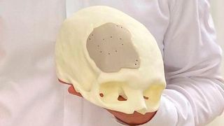 Mit dem FLM-Drucker R1 von Kumovis lassen sich Medizinprodukte aus Hochleistungskunststoffen unter Reinraumbedingungen herstellen. (Bild: Kumovis)