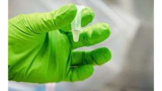 Abwasserprobe vor der Sequenzierung (Bild: Felix Petermann, Max Delbrück Center)