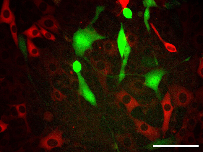 Zellen, in denen sich das Herpes-Virus vermehren kann, sind grün gefärbt. In Zellen, die auf die Interferon-Behandlung ansprechen (rot gefärbt), ist dies nicht möglich. (Bild: HZI/Cicin-Sain)