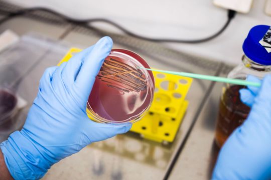 Überimpfen einer P. gingivalis-Probe nach Kultivierung zur weiteren Testung des Wirkstoffes. Die Bakterien werden im Labor auf Petrischalen auf einem Nährmedium (Agar) gezüchtet.(Bild:  © Nilz Böhme)