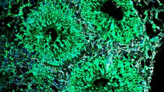 Menschliches Gehirnorganoid mit Ventrikeln, die aus neuralen Vorläuferzellen (grün) und neugeborenen Neuronen (grau) bestehen (Bild: MPI/Anthi Krontira)