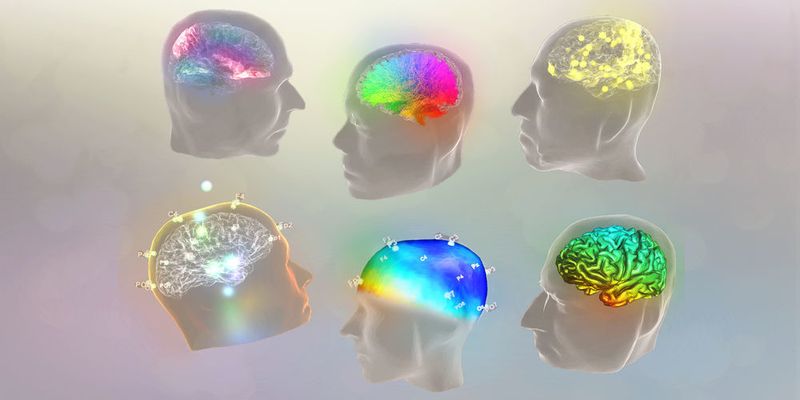 The Virtual Brain ist eine Open-source-Software zur personalisierten Simulation von Gehirnen. (Jessica Palmer/The Virtual Brain)