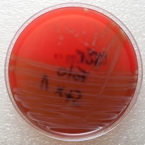 53 Menschenleben forderte der EHEC-Stamm O104:H4 im Jahr 2011, insgesamt erkrankten 3.842 Personen. Aus Angst vor einer Infektion aßen Millionen Bundesbürger wochenlang kein Gemüse mehr. Dadurch entstand in der Branche ein wirtschaftlicher Schaden in Millionenhöhe.