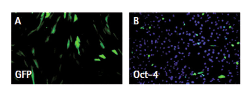 Abb.2: Fluoreszierende Mikrographie von HFFs nach Transfektion mit einer GFP-RNA-Replikon-Kontrolle (A) oder mit Simplicon Reprogramming RNA (B) und Analyse am folgenden Tag zur Beurteilung der Transfektionseffizienz. Das grüne Signal in (B) spiegelt die OCT-4-Expression wieder. (Bild: Merck Millipore)