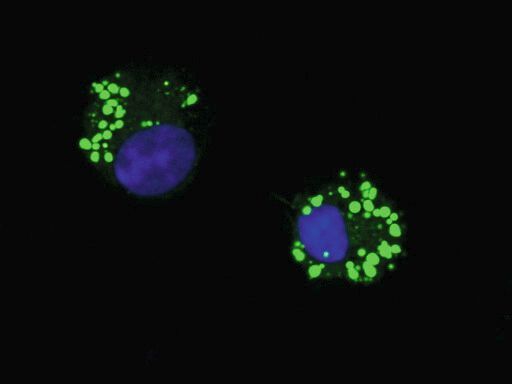 Das Bild zeigt zwei Lymphoid-Zellen (ILC; die Zellkerne sind blau markiert), die in kleinen Fetttröpfchen (lipid droplets, grün) externe Fettsäuren gespeichert haben. 