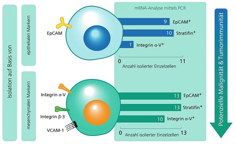 Abb.4: Mithilfe der neuentwickelten automatisierten Plattform konnten einzelne zirkulierende Tumorzellen aus Blutproben von Krebspatienten minimal-invasiv isoliert und anhand der Expression ihrer Oberflächenmerkmale in wichtige Untergruppen klassifiziert werden. Zur Bestimmung von CTCs dient grundsätzlich ein Nachweis von epithelialen Markern wie EpCAM und Stratifin. Ist zusätzlich eine Isolation durch Oberflächenmoleküle wie Integrin und Stammzellmarker wie VCAM-1 und deren PCR-Nachweis möglich, könnte dies potenziell für eine höhere Metastasierungsfähigkeit dieser CTCs sprechen.