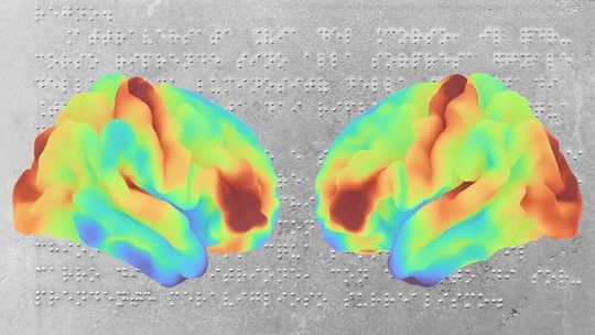 Die Forschenden konnten die Mikrostruktur des Gehirns blinder Menschen im Submillimeterbereich abbilden und so wichtige Muster aufdecken.(Bild:  © MPI CBS)