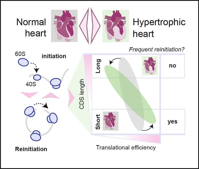 Schematische Übersicht, die den Vergleich zwischen einem normalen und einem hypertrophen Herzen zeigt 