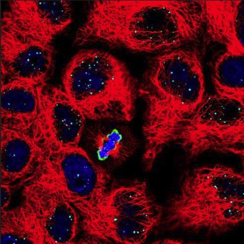 Gestörte Zellteilung nach CRISPR   Eine neue Studie der Tel Aviv University (TAU) weist auf Risiken bei der Verwendung von CRISPR-Therapeutika hin. Solche Wirkstoffe verändern mit hoher Präzision DNA-Moleküle und werden bereits zur Behandlung von Krebs, Leber- und Darmerkrankungen sowie genetischen Syndromen eingesetzt. Die Studie zu Auswirkungen dieser Technologie auf T-Zellen (weiße Blutkörperchen des Immunsystems) zeigte, dass bei einem erheblichen Prozentsatz – bis zu 10 % der behandelten Zellen – ein Verlust von genetischem Material auftrat. Die Forscher erklären, dass ein solcher Verlust zu einer Destabilisierung des Genoms führen kann, was wiederum Krebs verursachen könnte. „Die CRISPR-Genom-Editierungsmethode ist sehr effektiv, aber nicht immer sicher. Manchmal erholen sich die durchtrennten Chromosomen nicht und die Stabilität des Genoms wird beeinträchtigt – was auf lange Sicht Krebs fördern kann“, warnen die Forscher um Dr. Adi Barzel.  Das Bild zeigt die Chromosomentrennung in sich teilenden Zellen (Rot: Zytoskelett der Zellen; Blau: DNA; Grün: ein Protein, das die sich teilenden Zellen markiert). Hier gehts zur Originalmeldung Wissenschaftsbild des Tages vom 28.7.2022  (Tom Winkler, Laboratory of Dr. Uri Ben-David)