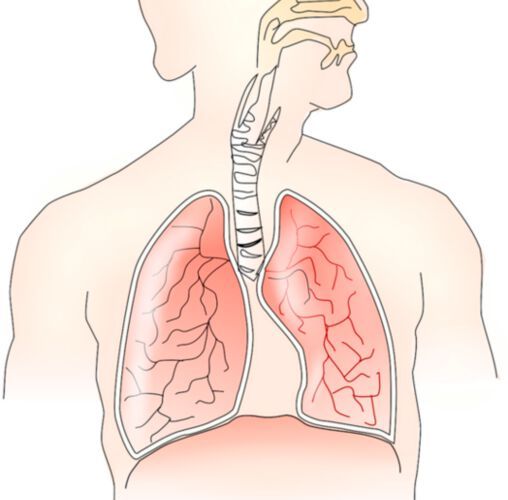 The study found common cell states between lung fibrosis, cancer and Covid-19, offering new ways of understanding lung disease, which could help identify new therapeutic targets. The study found common cell states between lung fibrosis, cancer and Covid-19, offering new ways of understanding lung disease, which could help identify new therapeutic targets.