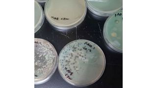 The dark spots in the dishes mark areas where phage burst out of the bacteria, killing them. (Source: Cole Wilson/Northwestern University)