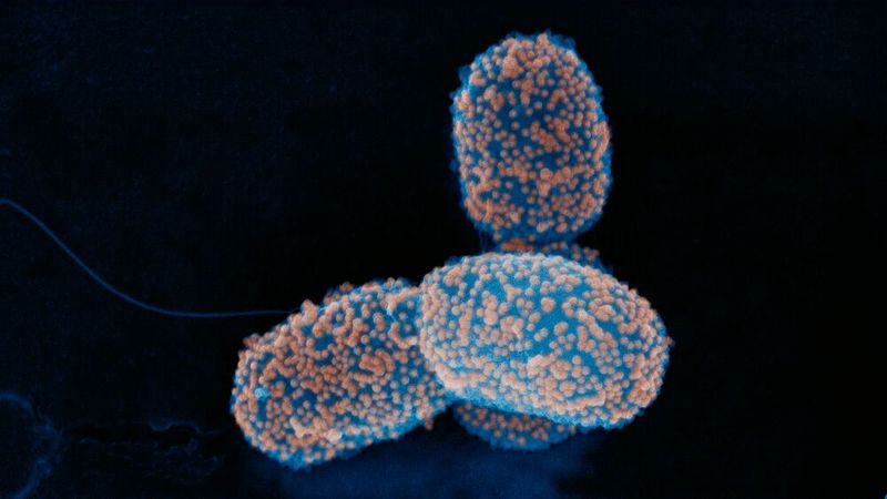 Auch so können Roboter aussehen: Diese Bakterien sind mit magnetischen Nanopartikeln ummantelt, so dass sie sich mittels Magneten durch die Blutbahn an eine bestimmte Körperstelle lotsen lassen. (Bild: Stephan Handschin / ScopeM, ETH Zürich)