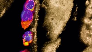 Entzündungshemmende Makrophagen (bunt), die auf Parasiten-Larven „sitzen“. (J. Esser-von Bieren)