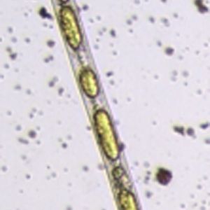 Mikroskopische Aufnahme eines Fadenwurms Radopholus similis: In dem Nematoden sind deutlich die Fetttröpfchen zu sehen, die die Abwehrsubstanz, das Phenylphenalenon Anigorufon (gelb), enthalten.
