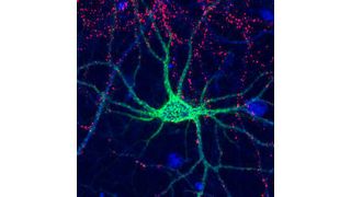 Complex sugar molecules control the formation of perineuronal nets (shown here in green) that surround neurons to help stabilize connections in the brain. (Source: Linda Hsieh-Wilson’s lab)