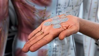 Edge-AI trifft Medizintechnik: Neurostimulation mit lokaler KI-VerarbeitungMit dem minimalinvasiven Gehirnstimulationssystem EASEE sind neue Therapien für medikamentenresistente Epilepsie mögilch. (Bild: Precisis)