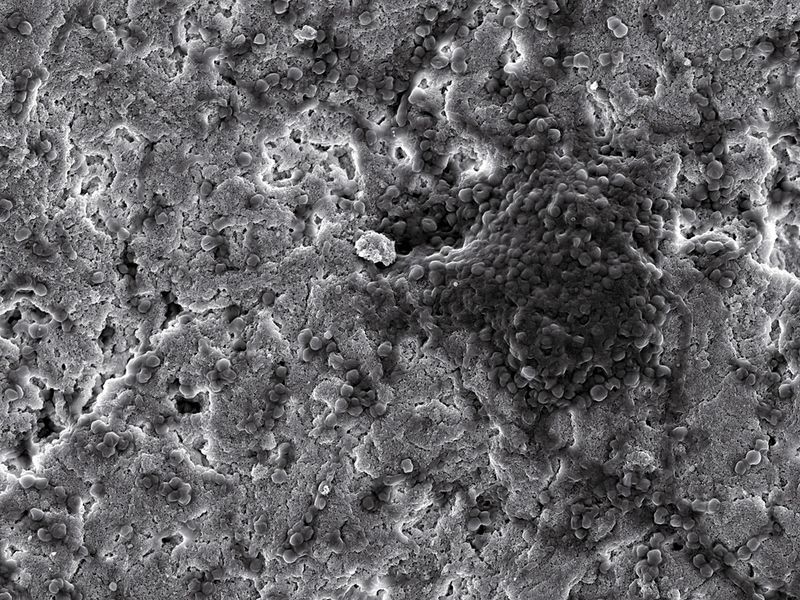 Infektion vorprogrammiert: Auf der Oberfläche eines Kalziumphosphatapatit, der nicht mit antimikrobiell wirksamen Substanzen modifiziert wurde, wachsen Staphylococcus-Bakterien. (Bild: Fraunhofer IGB)