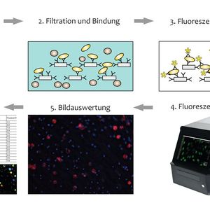 Abb. 2: Schematischer Ablauf von Immunofiltration und Filtermikroskopie(Bild:  fzmb)