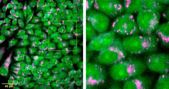 Researchers developed a Raman microscope that can acquire information hundreds of times faster than a conventional Raman microscope. This extra speed makes it possible to acquire large-area hyperspectral images of living cells, such as the ones seen here. Researchers developed a Raman microscope that can acquire information hundreds of times faster than a conventional Raman microscope. This extra speed makes it possible to acquire large-area hyperspectral images of living cells, such as the ones seen here.