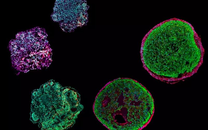 Mini-Herzen in der Kulturschale  Ein Team der Technischen Universität München (TUM) hat Stammzellen angeregt, die Entstehung des menschlichen Herzens nachzubilden. Das Ergebnis ist ein Organoid, eine Art Miniatur-Herz. Damit können Forscher die Entwicklung des menschlichen Herzens im Labor nachahmen und erbliche Herzerkrankungen untersuchen. Das Bild zeigt die ca. 0,5 Millimeter großen „Epicardioids“ – Organoide aus pluriopotenten Stammzellen.   Hier gehts zur Originalmeldung Wissenschaftsbild des Tages vom 11.4.2023 (Alessandra Moretti / TUM)
