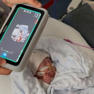 Den Rookie Awards hat IAM3DHUB mit ihrem Projekt „3DMyMask“ erhalten. Das Unternehmen nutzt die Additive Fertigung in Kombination mit einem 3D-Gesichtsscan, um maßgeschneiderte  Silikonmasken herzustellen und so zum Beispiel die Behandlung von Atemnot zu  verbessern. Bis zu 75 % der Frühgeborenen benötigen eine nicht-invasive Beatmung. Standardisierte Interfaces berücksichtigen die empfindliche Variabilität der Neugeborenenanatomie nicht und führen zu Luftleckagen, Druckverletzungen und kraniofazialen Deformationen. Die maßgeschneiderten Silikonmasken, die mit 3D-Gesichtsscans und additiven Technologien gefertigt werden, ermöglichen eine anatomische Anpassung, reduzieren Leckagen, verteilen den Druck sicherer und erhöhen den Patientenkomfort.(Bild:  IAM3DHUB)