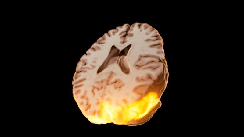 Dieses Bild, eine Fusion aus anatomischen und funktionellen MR-Aufnahmen, zeigt die Gehirnareale, die beim Anschauen eines Hauses aktiv sind. (Fraunhofer MEVIS)