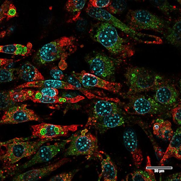  Übergewicht durch Mini-Proteine?    Mitochondrien sind die Kraftwerke unserer Zellen. Die Aufrechterhaltung des mitochondrialen Stoffwechsels erfordert den Input vieler Moleküle und Proteine, von denen einige noch entdeckt werden müssen.  Forschende des Salk Institutes untersuchen genauer, ob Mitochondrien auf Mikroproteine angewiesen sind – kleine Proteine, die bisher schwer zu finden waren und deren Rolle in Gesundheit und Krankheit deshalb unterschätzt wurde. In ihrer neuen Studie wurde ein Mikroprotein, das erst letztes Jahr am Salk entdeckt wurde, namens SLC35A4-MP, als entscheidend für die Aufrechterhaltung der mitochondrialen Struktur und die Regulierung von metabolischem Stress in Mäusefettzellen identifiziert.  Ohne SLC35A4-MP waren Mäuse nicht in der Lage, ihren Stoffwechsel bei Kälteeinwirkung hochzudrehen. Ihre Mitochondrien waren strukturell beeinträchtigt, vergrößert, dysfunktional und entzündet. Außerhalb der Mitochondrien waren auch andere Teile der braunen Fettzellen betroffen. Die Erkenntnisse pflanzen den Samen für zukünftige Behandlungen auf Mikroproteinbasis gegen Fettleibigkeit, Alterung und andere mitochondriale Erkrankungen.  Das Bild zeigt reife braune Mausfettzellen. Farbig hervorgehoben sind SLC34A4-MP (rot), DNA (blau), und Mitochondrien (grün).   Hier gehts zur Originalmeldung Wissenschaftsbild des Tages vom 02.9.2025  (Bild: Salk Institute)