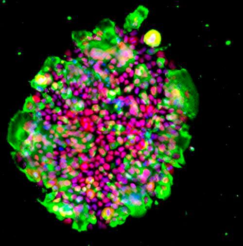 Ace2-expressing iPS cells grown with iMatrix-511 as ECM in StemFit medium; infected with SARS-CoV-2 virus after cryopreservation in Stem Cellbanker. Green: SARS-CoV-2 N protein, Red: OCT3/4, Blue: DAPI. 
