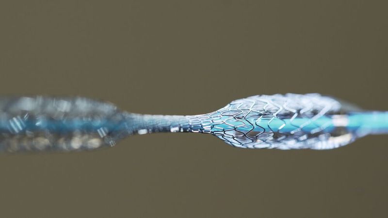 3) Formgedächtnislegierungen – Metalle mit Erinnerung Nitinol und andere Formgedächtnislegierungen „erinnern“ sich an ihre ursprüngliche Form. Nach extremer Verformung kehren sie bei Erwärmung automatisch in ihre Grundform zurück. In der Medizin ermöglichen sie selbstexpandierende Stents und superelastische Zahnspangen. William J. Buehler und Frederick Wang entwickelten Nitinol 1958/59 am US Naval Ordnance Laboratory; 1962 wurde es der Öffentlichkeit vorgestellt.  Quelle: Hoh et al., Neurosurgery (2009) - Nitinol in der Neurochirurgie Entdeckung: Spektrum der Wissenschaft - Legierungen die sich an Formen erinnern    LP-Lesetipp: Formgedächtnis-Mikroventile in 3D-Drucktechnik (Bild: © Alex Traveler - stock.adobe.com)