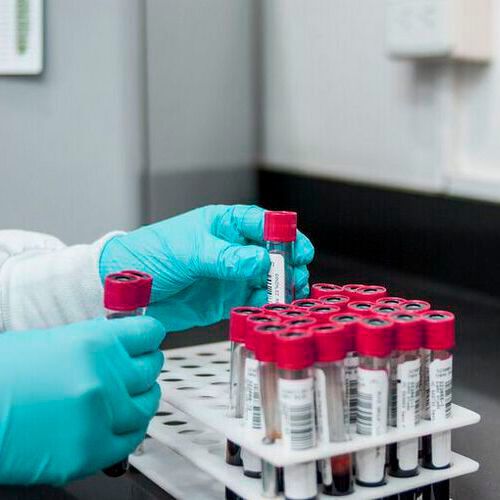 The audit, which collected anonymized data on blood tests for over 2,500 patients from 57 GP practices, also found that a quarter of tests may have been partially or fully unnecessary when reviewed retrospectively by another clinician. The audit, which collected anonymized data on blood tests for over 2,500 patients from 57 GP practices, also found that a quarter of tests may have been partially or fully unnecessary when reviewed retrospectively by another clinician.