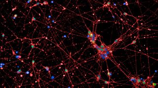 Aus menschlichen Stammzellen hergestellte Nervenzellen (rot und grün). In orange markierten Zellen ist das Sättigungsgen POMC aktiv. Blau: Zellkerne.  (Bild: © Charité | Lara Lechner)