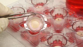 Aus Hautzellen züchten die Wissenschaftler Hautmodelle, an denen neue Anti-Krebswirkstoffe und andere Medikamente getestet werden können. (Bild: Freie Universität Berlin)