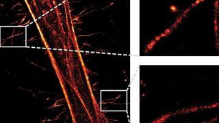 Beobachtung von einzelnen Histidin-markierten Zytoskelletmolekülen mit Hilfe der Super-Resoltuion Mikroskopie (dSTORM). Links ein markiertes Aktin (Zytoskelett-Bestandteil), rechts zwei Vergrößerungen. (Bild: Goethe-Universität Frankfurt)