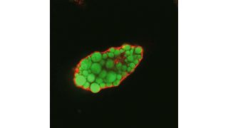 Lipidtropfen (angefärbt) in einer Fettzelle ohne EHD2. (Bild: Claudia Matthäus, MDC)