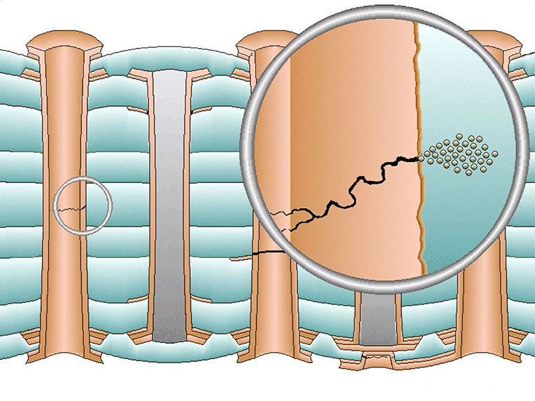 Hülsenrisse entstehen, wenn die Kupferwand einer Durchkontaktierung durch wiederholte thermomechanische Belastungen ermüdet und quer oder schräg zur Bohrungsachse aufreißt. (Bild: Polas Instruments)