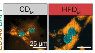 Mehr Lipide (gelb, LD540) interagieren mit Molekülen, die aus Kupffer-Zellen von Nachkommen fettleibiger Mäuse stammen (rechts, HFDM). Links sind zum Vergleich Leberzellen zu sehen, die Faktoren von Nachkommen normalgewichtiger Mütter ausgesetzt waren (CDM). Die Zellkerne sind in Cyan dargestellt.  (Bild: AG Mass/Uni Bonn)