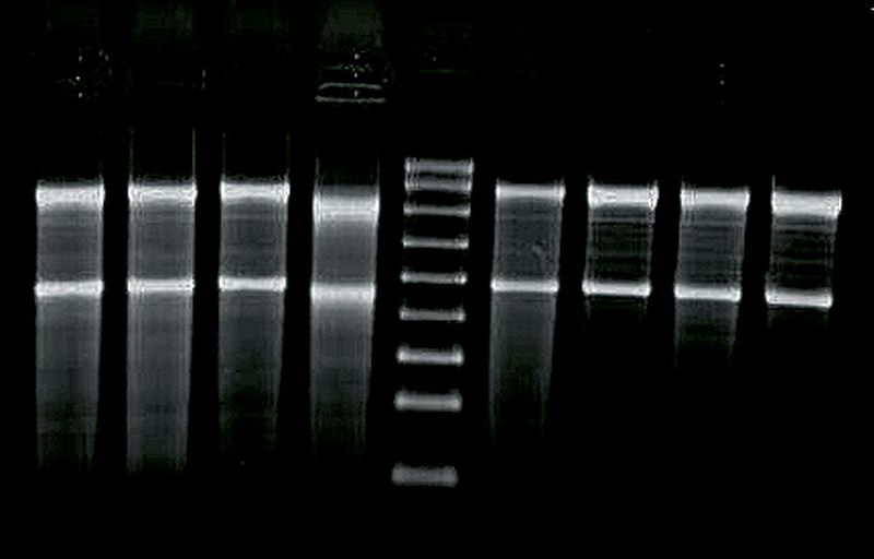 Abb.5: Formaldehyd-Gel-Bild von mit der beschriebenen Methode aufgereinigten Gesamt RNA-Proben. (Archiv: Vogel Business Media)