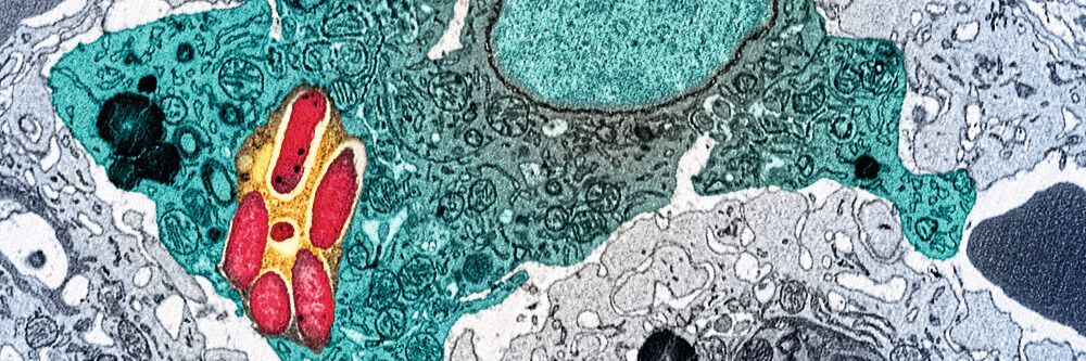 Warum Magnesiummangel Gut Gegen Magen Darm Grippe Ist