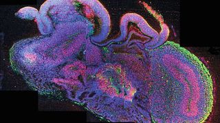 Querschnitt eines vollständigen cerebralen Organoids mit verschiedenen Gehirnregionen. Zellen sind in blau, neuronale Stammzellen in rot und Neuronen in grün dargestellt. (Bild: Querschnitt Gehirnmodell / IMBA/ Lancaster / CC BY-SA 4.0)