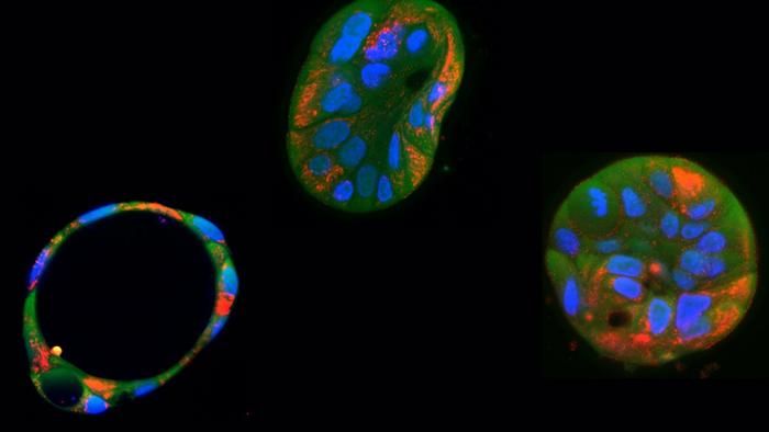  Gen-Tool gegen defekte Mitochondrien  Das Gitelman-ähnliche Syndrom ist eine renale Tubulopathie, die Symptome wie Hypomagnesiämie, Hypokaliämie, Hypocalciurie und metabolische Alkalose aufweist. Diese Erkrankung kann durch Mutationen in der mitochondrialen DNA verursacht werden, insbesondere in Genen, die für mitochondriale tRNAs kodieren, und führt zu einer beeinträchtigten Funktion der Mitochondrien in den Nierenzellen.  Wissenschaftler in den Niederlanden haben mithilfe eines genetischen Werkzeugs, dem sogenannten Basen-Editor, schädliche Mutationen in mitochondrialer DNA erfolgreich korrigiert. Diese Technik ermöglicht es, eine einzelne DNA-Base zu ändern, ohne die DNA zu schneiden und wurde in der Studie auf Leber- und Hautzellen angewandt, um mitochondriale Mutationen zu erzeugen und zu korrigieren. Dabei stellten sie in einem Krankheitsmodell die mitochondriale Funktion wieder her. Darüber hinaus testeten sie die Effizienz der Verabreichung von mRNA statt DNA, was weniger zellschädigend ist. Diese Forschung bietet neue Hoffnung für die Behandlung seltener genetischer Störungen.  Auf dem Bild sind patientenabgeleitete Leberorganoide und deren Mitochondrien (rot) zu sehen.  Hier gehts zur Originalmeldung Wissenschaftsbild des Tages vom 01.7.2025 Bildquelle: Martijn Koppens:  Patientenabgeleitete Leberorganoide und deren Mitochondrien , (CC BY 4.0)   (Bild: Martijn Koppens)