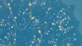 Mikroskopische Aufnahme der Fruchtkörper von D. discoideum auf einer Agarplatte. An der Spitze des multizellulären Organismus, wo sich auch die ruhenden Sporen befinden, ist das gelbe Pigment sichtbar. (Bild: Rosa Herbst/Leibniz-HKI)