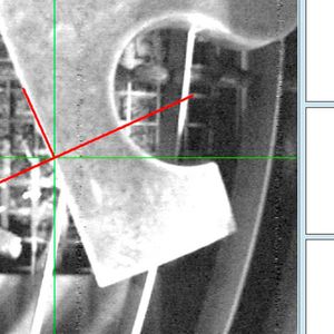 Während des Scanvorgangs, so Microstep, werden die programmierte und die reale Kontur des Bauteils verglichen.