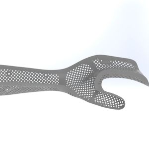 Auch den additiven Orthesenbau will IFC weiter voranzutreiben.(Bild:  IFC)