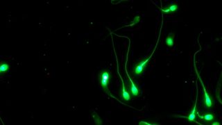 Sample of human spermatozoa (Source: Rita Rahban)