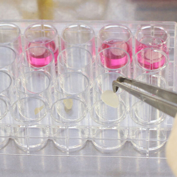 In Zellkulturgefäßen besiedeln dann Zellen diese kreisrunden Disks. (Bild: Fraunhofer EMB)