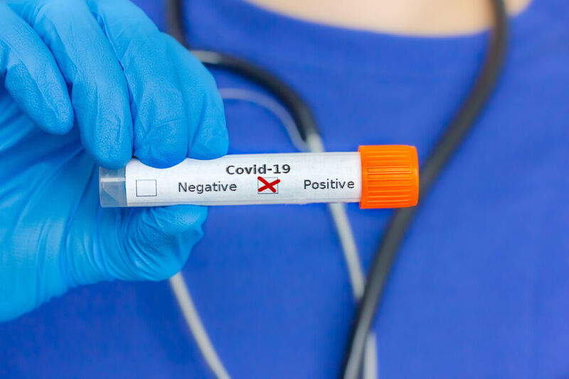 Test-Kits auf das neuartige Coronavirus sind stark nachgefragt. Die Produktion kommt kaum noch hinterher (Symbolbild).